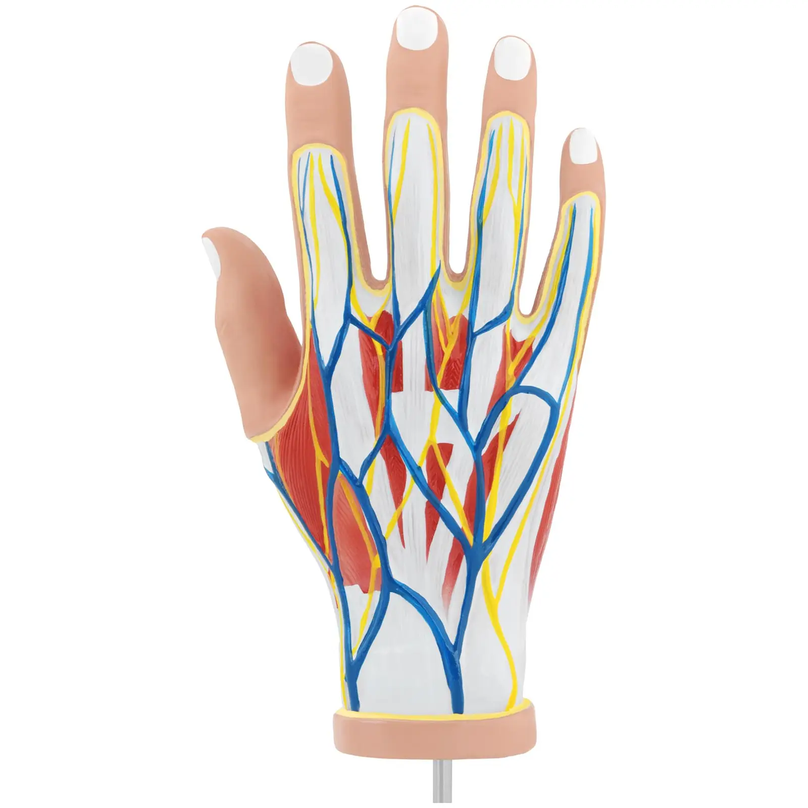 Anatomický model ruky - čtyřdílný - originální velikosti - degenerace svalů
